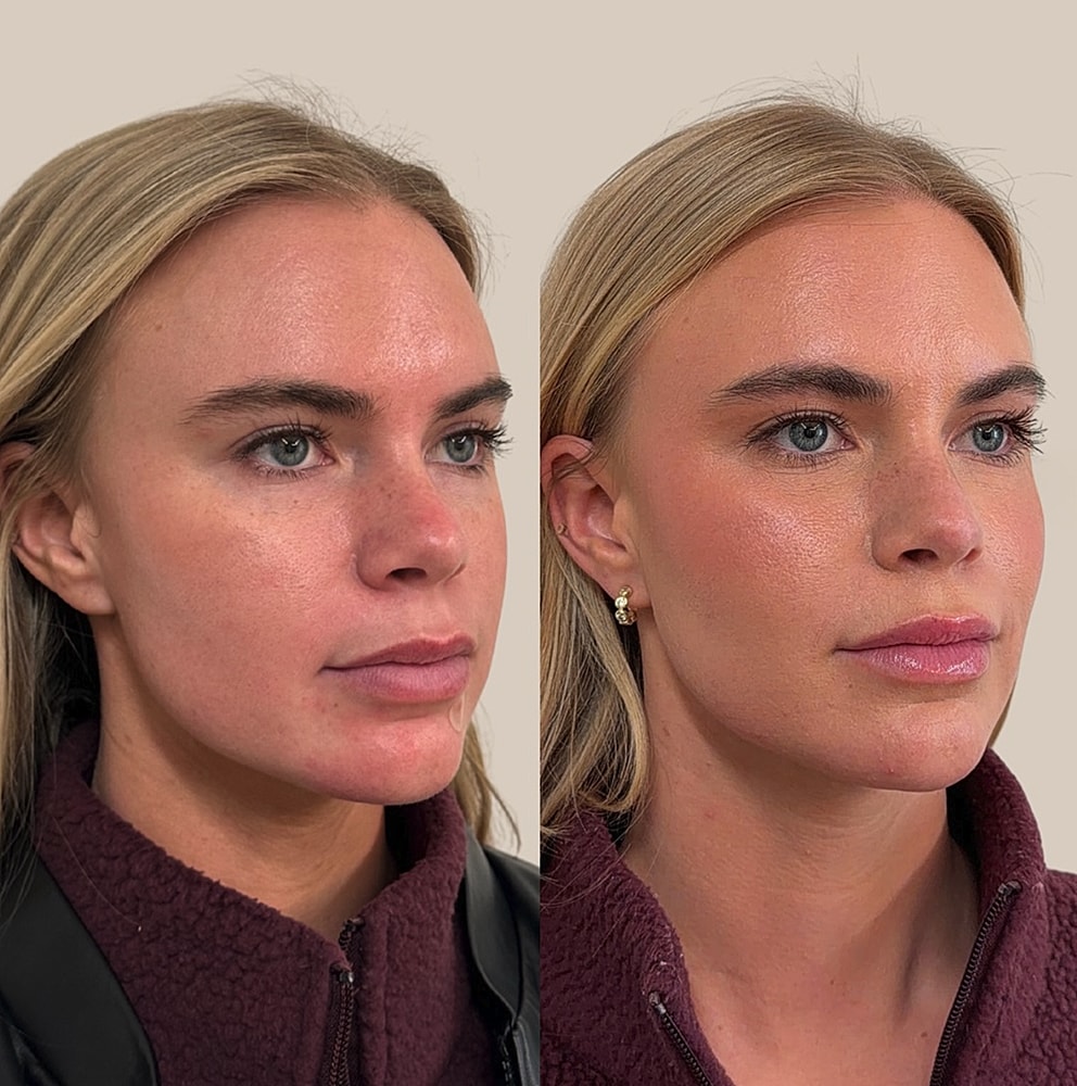 Before and after skincare transformation comparison.