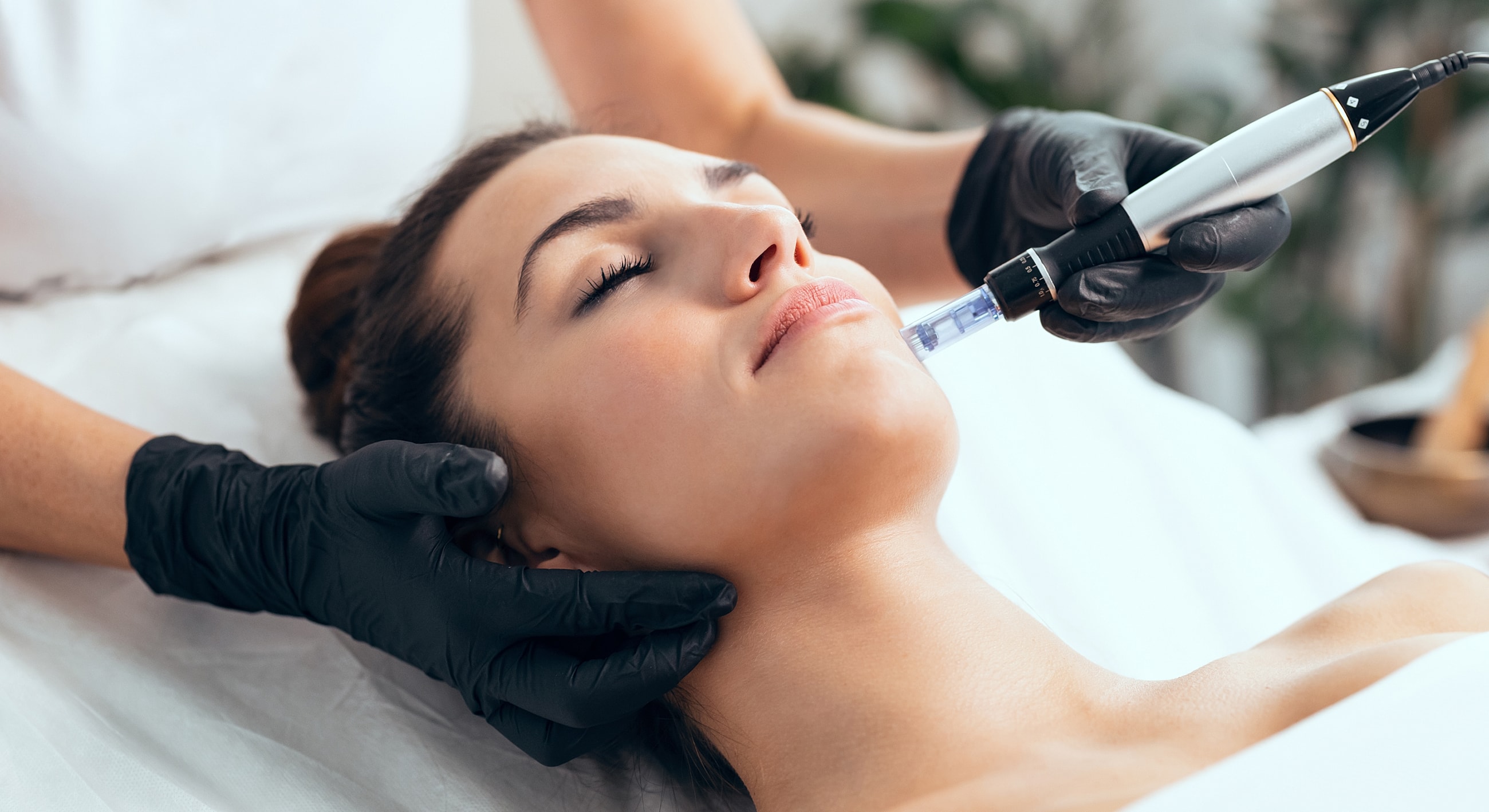 Microneedling facial treatment in progress.